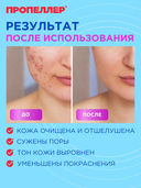 Лосьон для лица 